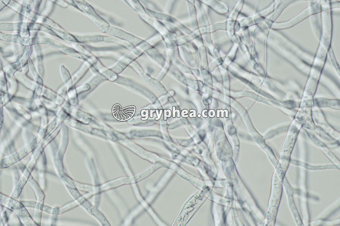 Réseau mycélien au microscope x160 - gryphea.org